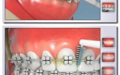 Higiene Oral em 3D